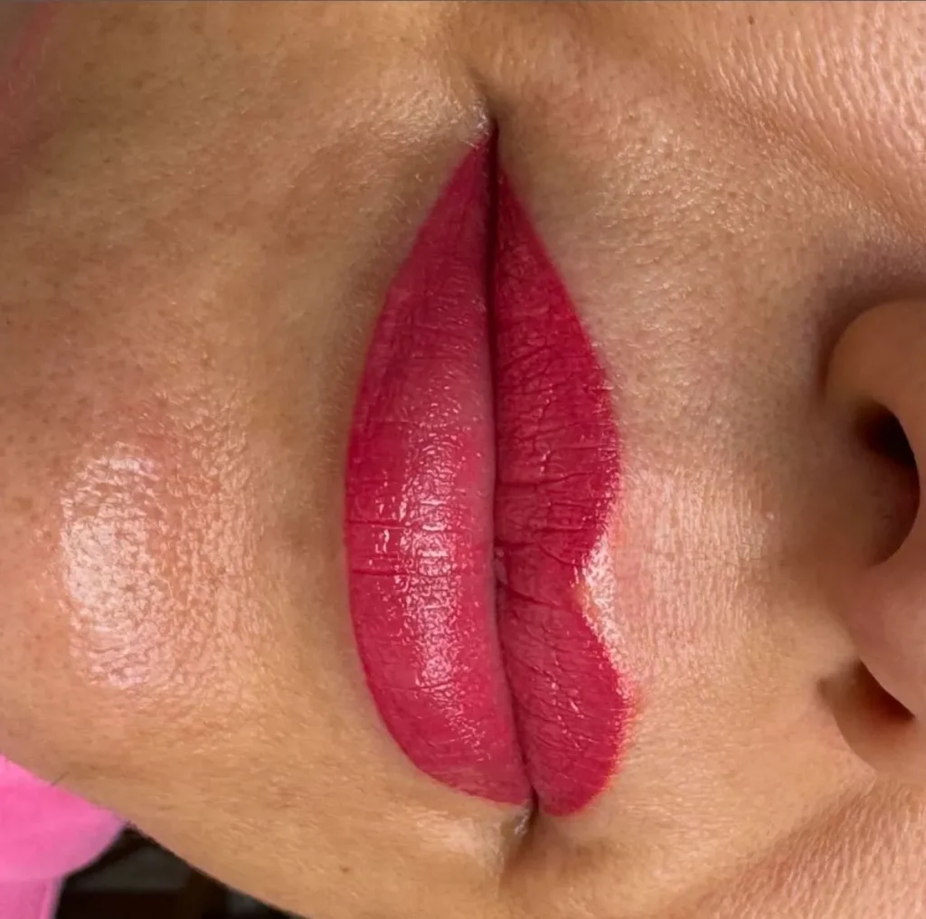 Week 2 and Beyond: Long-Term Lip Care